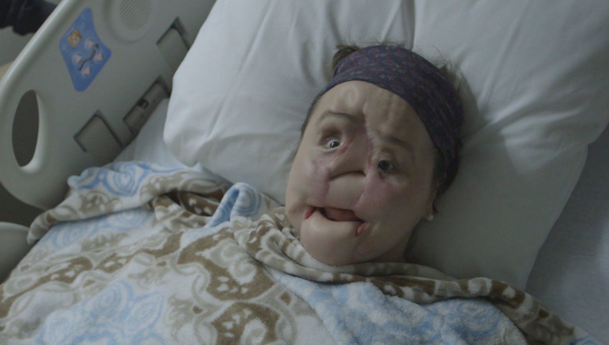 2014px x 1140px - An Unprecedented Look at a Young Woman's Face Transplant